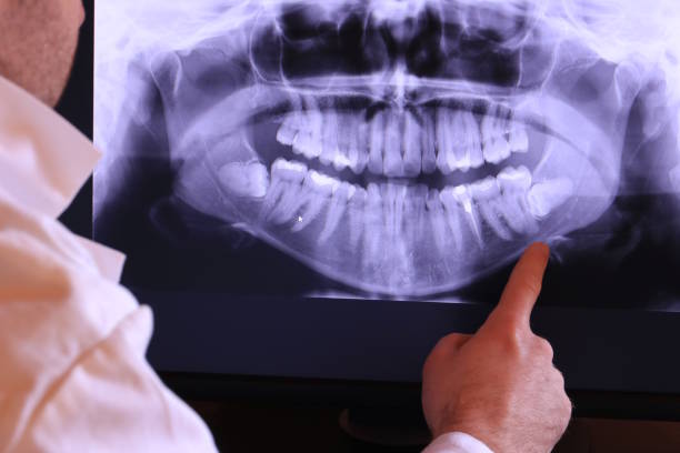 Best Emergency Treatment for Dental Infections or Abscesses in Barneveld, WI